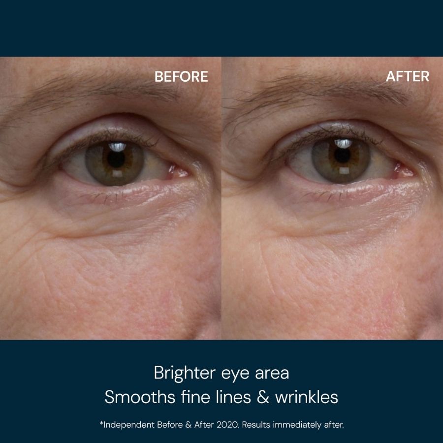 Eye Revive Mask