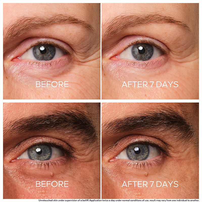 Eye Cream