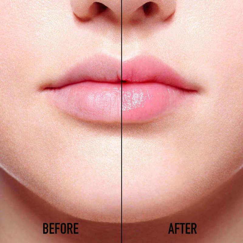 Lip Glow