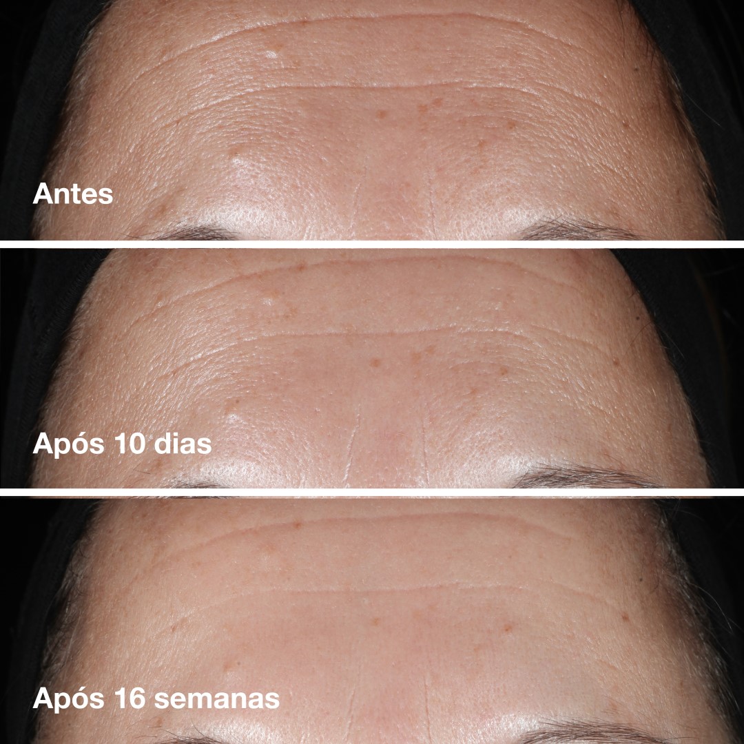 Smart Custom Repair Clinical Serum