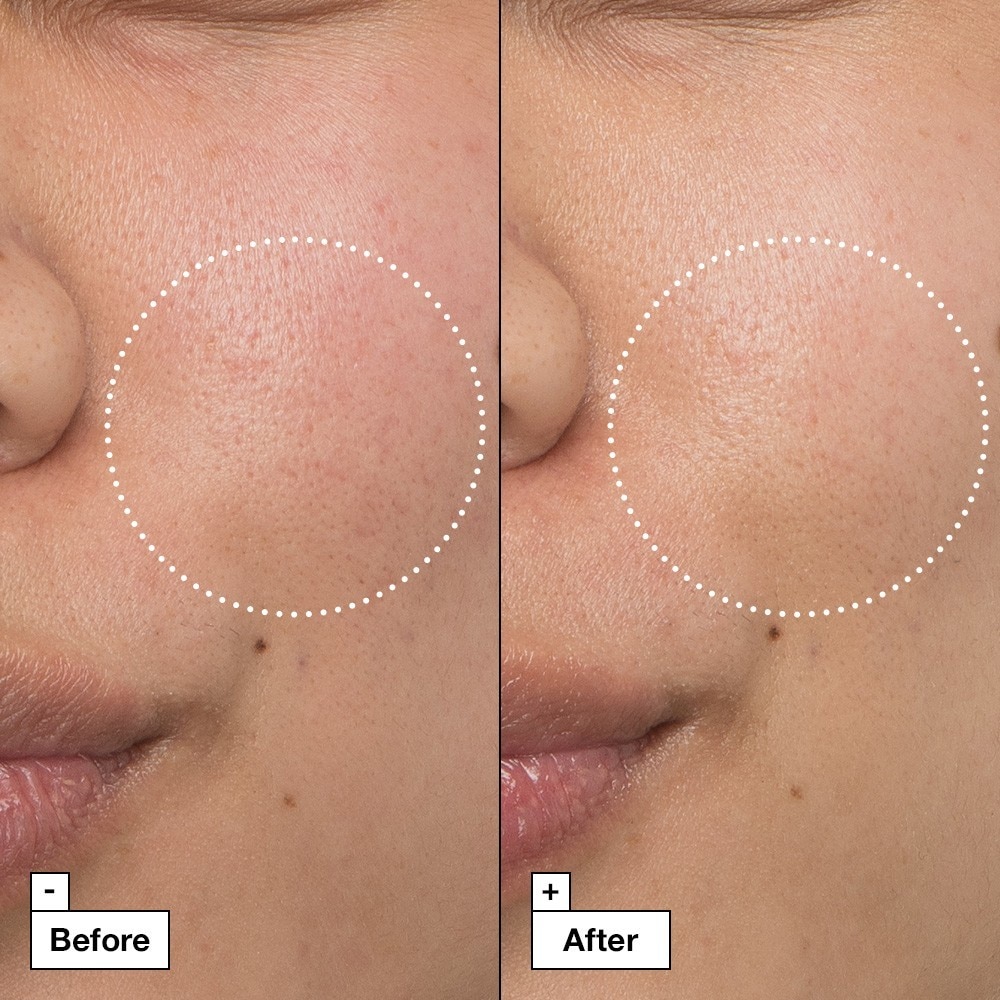 Intensive Sooth Repair Cream