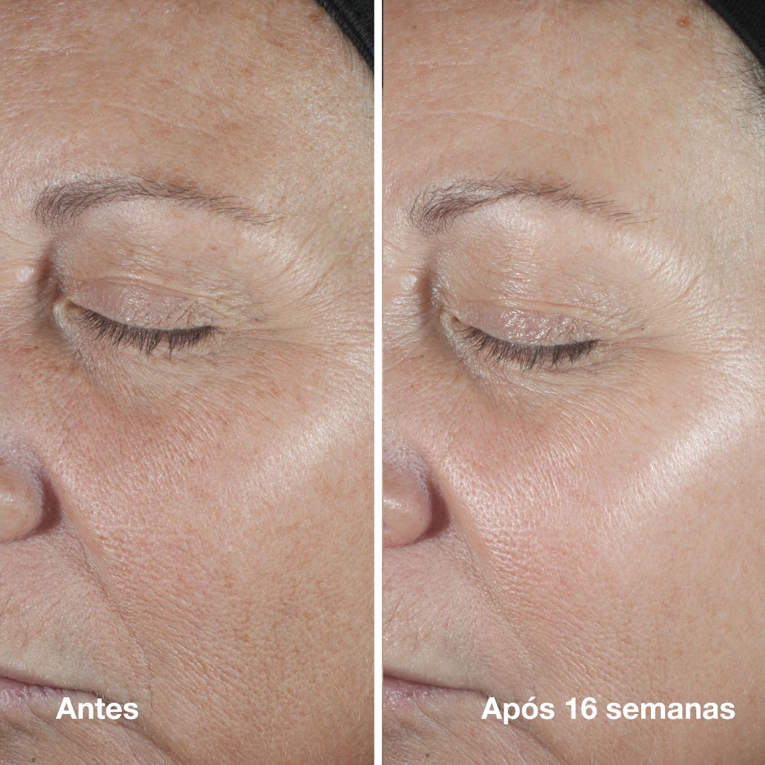 Smart Custom Repair Clinical Serum