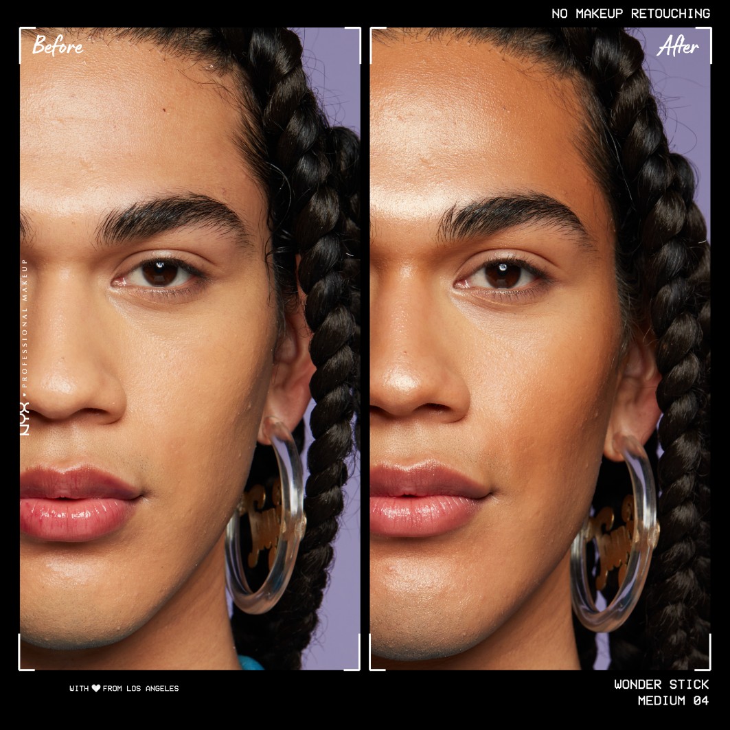 Dual Face Lift