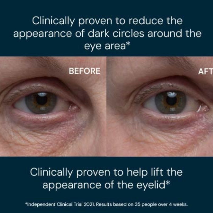 Vitality Eye Cream