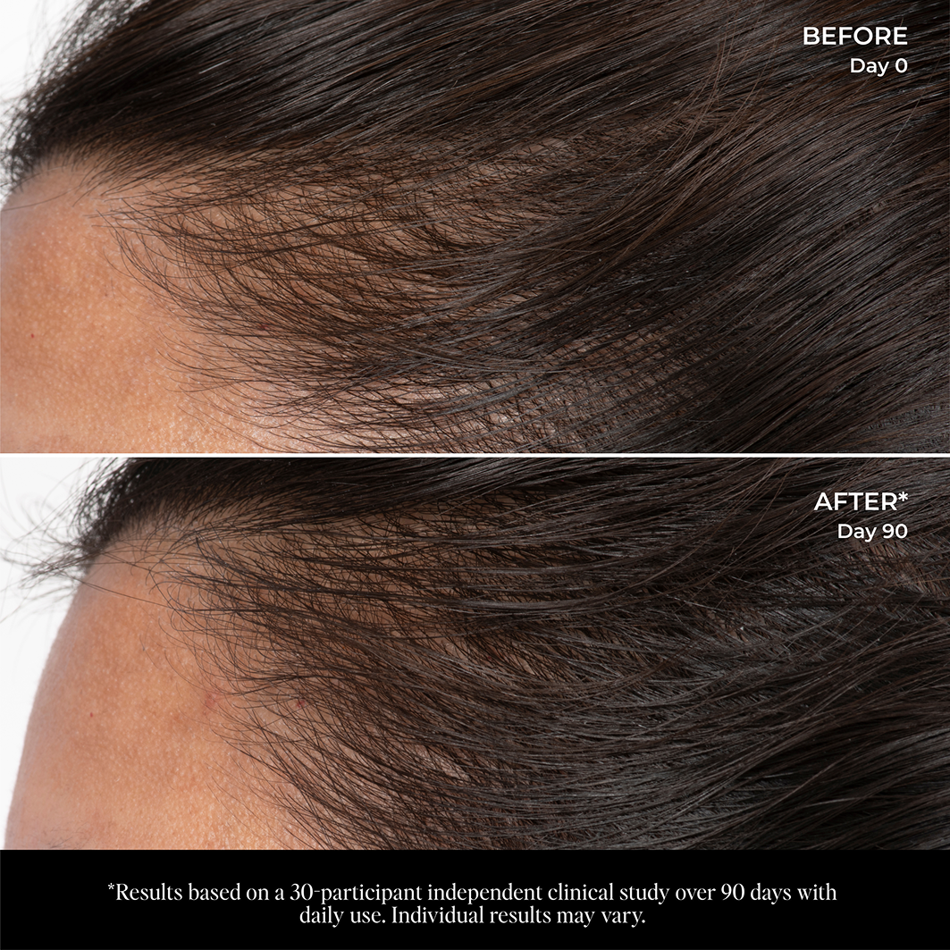 Hair Scalp Serum