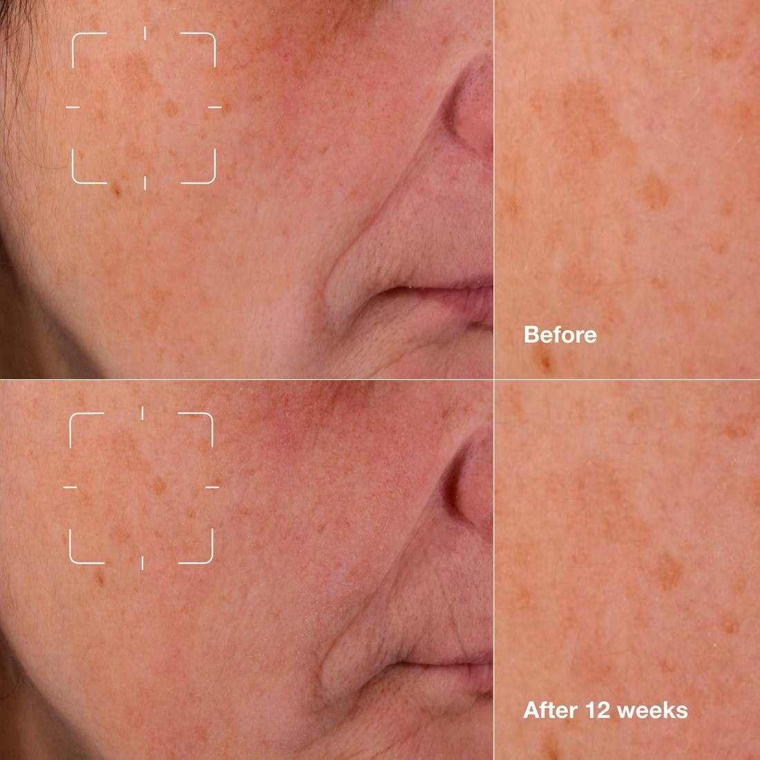 Dark Spot Clearing Serum