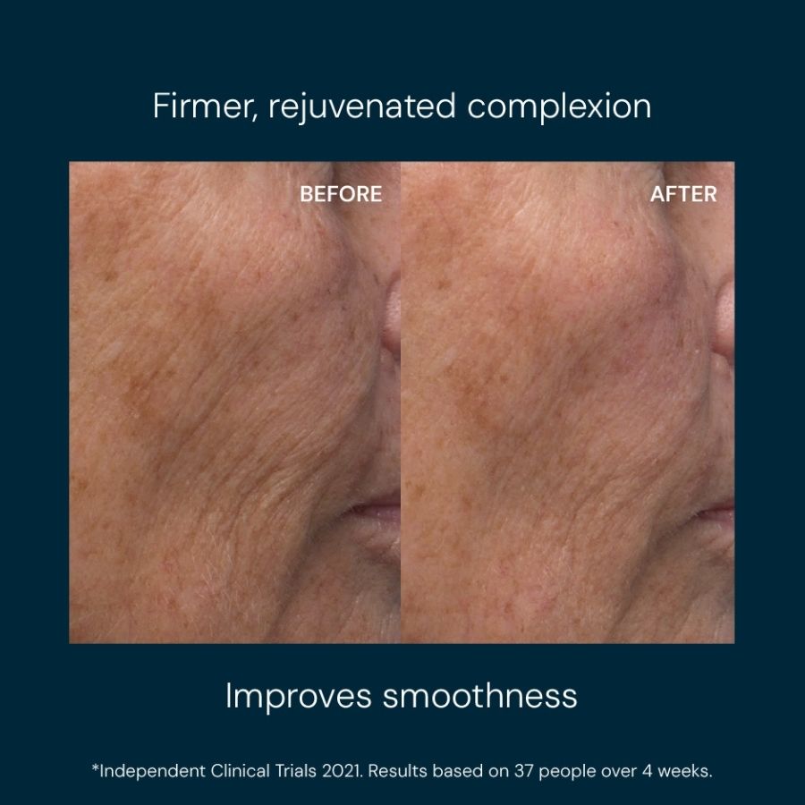 Renewal Serum