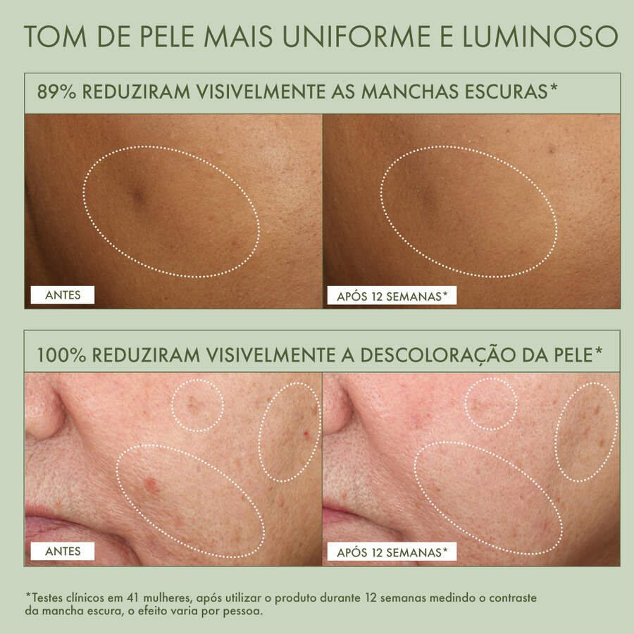 Hiperpigmentation Serum