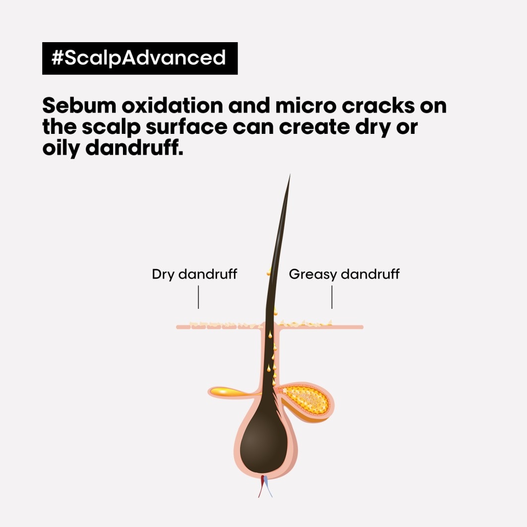Anti-Dandruff Shampoo