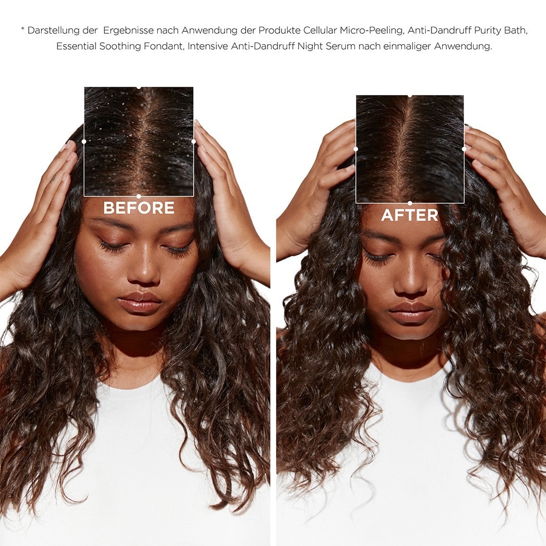 Bain Creme Anti-Pelliculaire