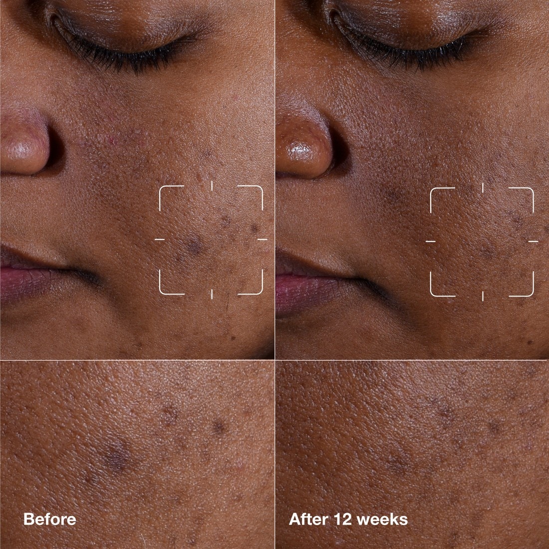 Dark Spot Clearing Serum