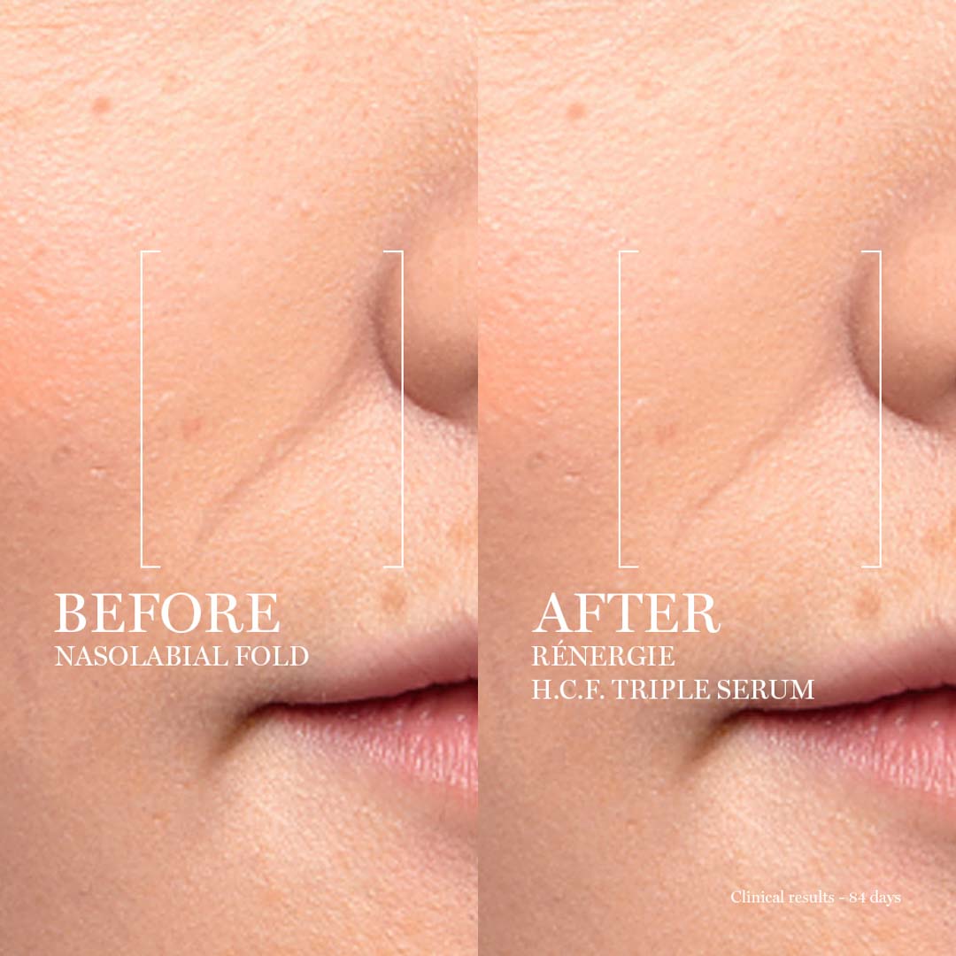 Rénergie H.C.F Triple Serum
