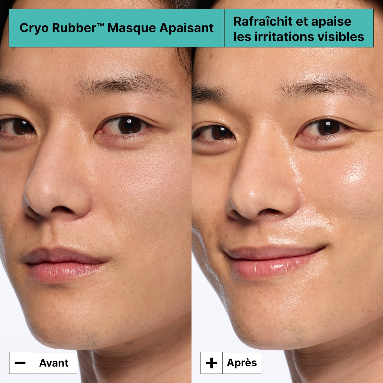 Sooth Allantoin Mask